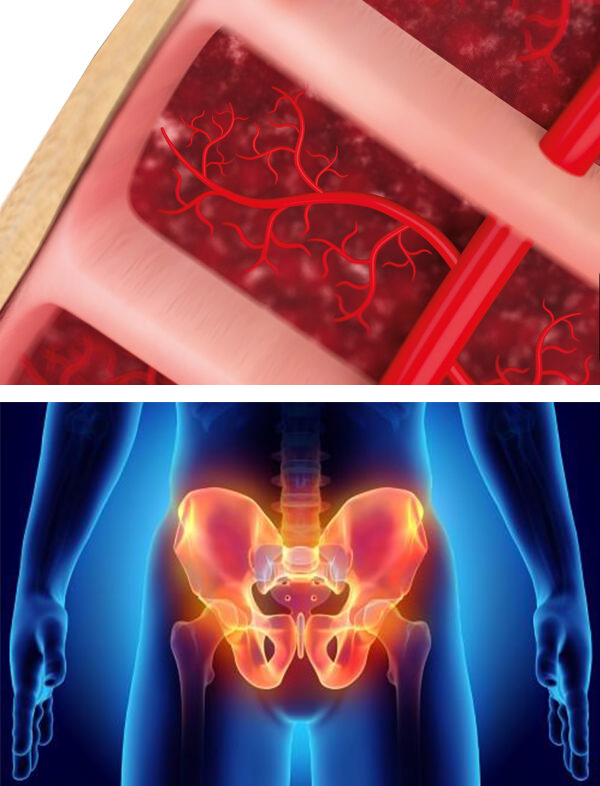 Causes of Erectile Dysfunction